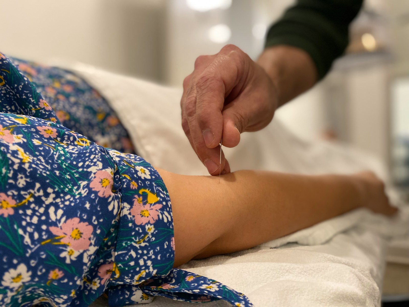 A registered acupuncturist placing sterile needles during a treatment session, an approach studied for depression and anxiety